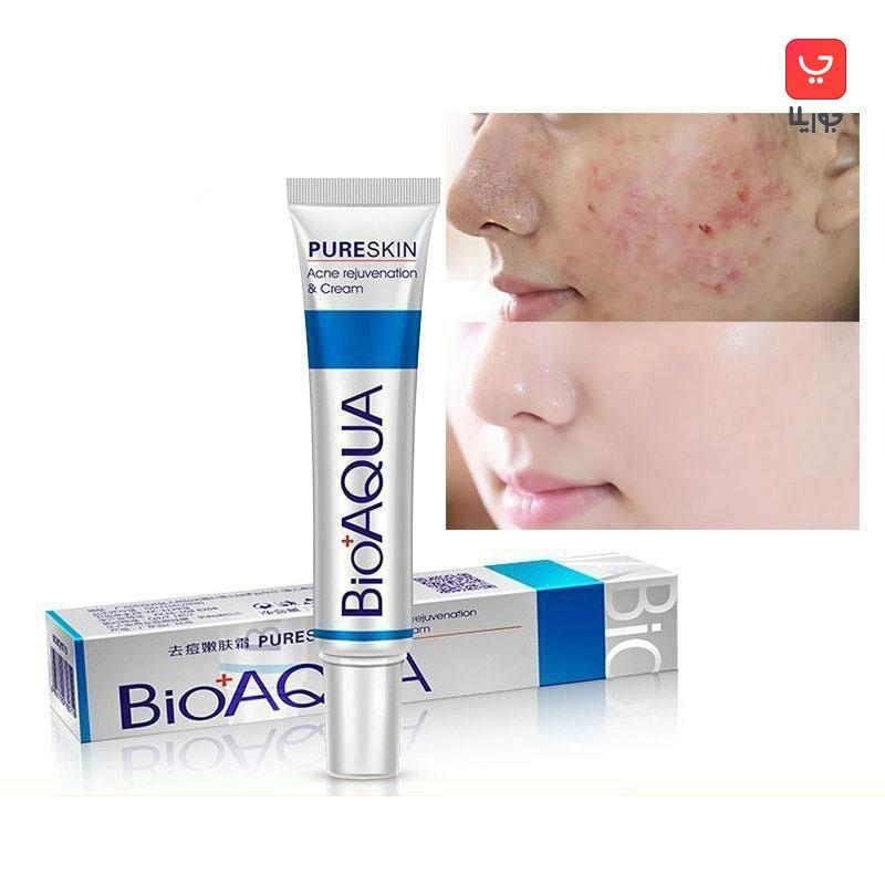 کرم ضد جوش بیوآکوا Bioaqua مدل Pure Skin
